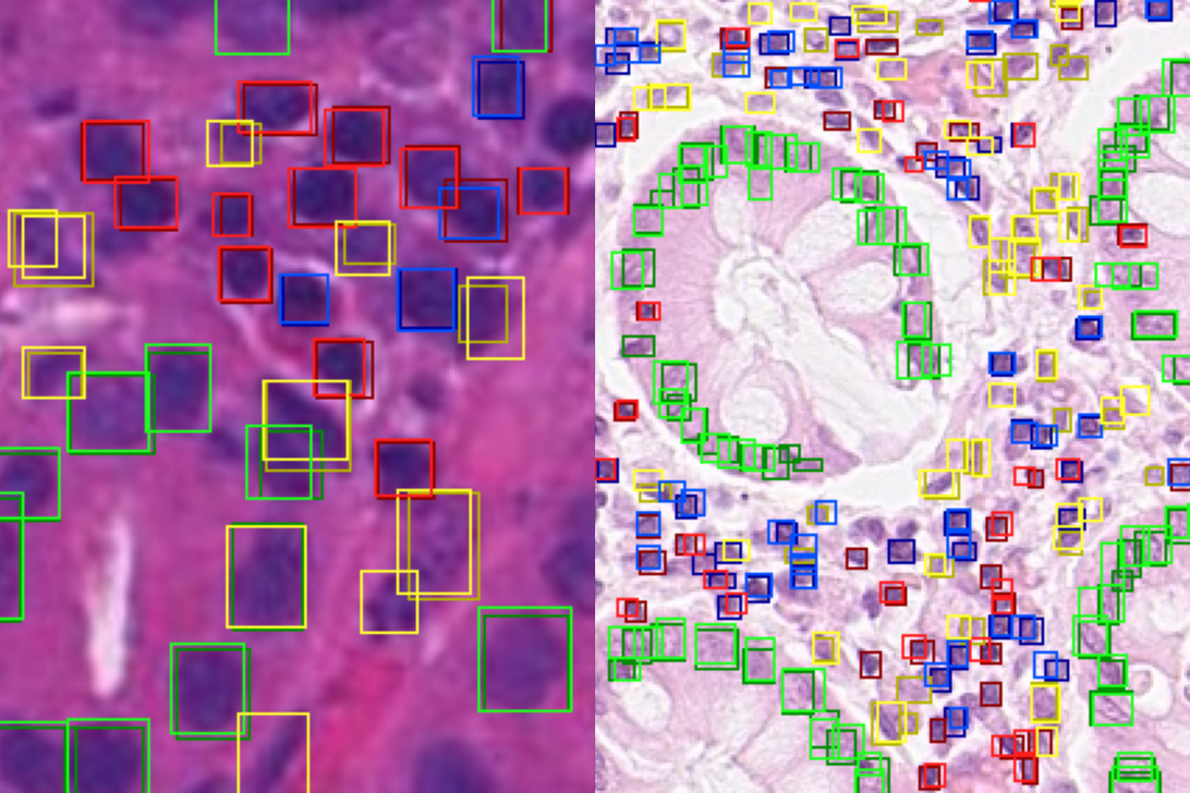 Bounding boxes on medical images.